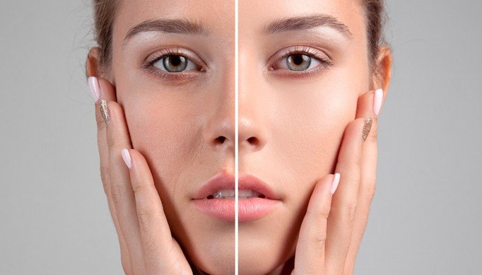 Homemade Microdermabrasion