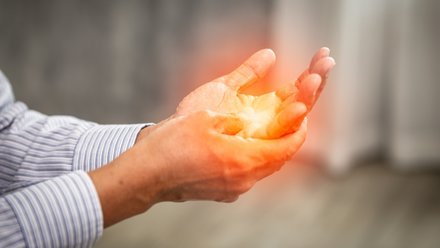 Dupuytren's contracture palmar