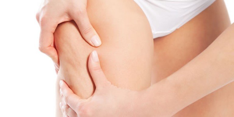 Essential Oils to Help Reduce and Prevent Cellulite